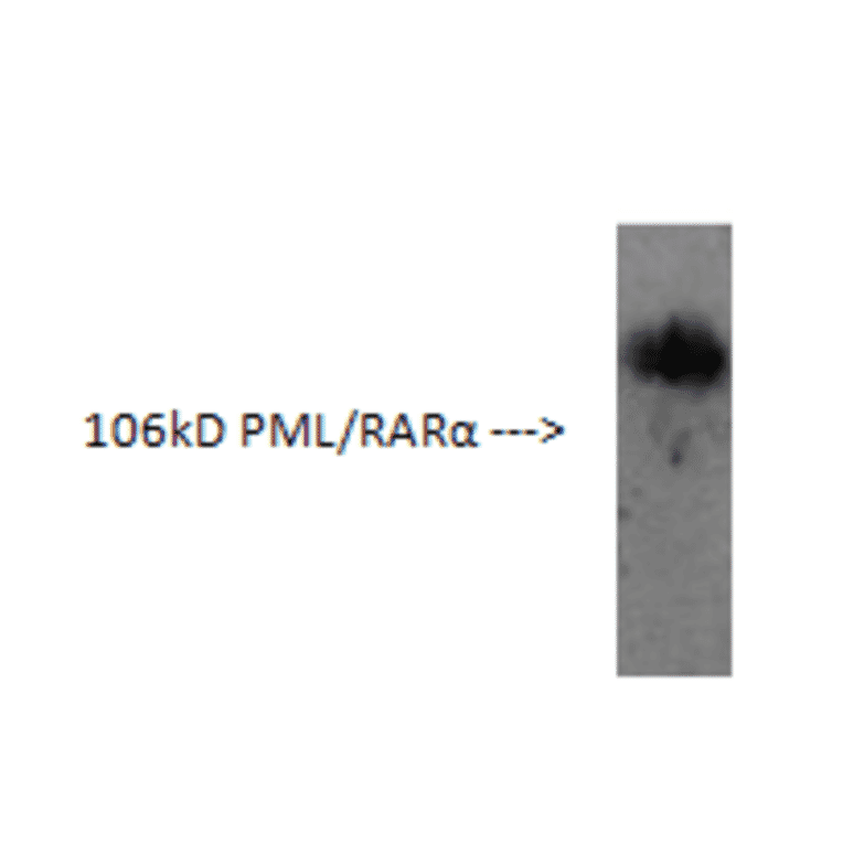 Western Blot - Anti-PML Protein Antibody (AI70002B) - Antibodies.com
