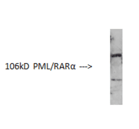Western Blot - Anti-PML Protein Antibody (AI70002A) - Antibodies.com
