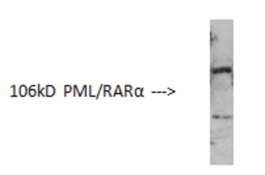 Western Blot - Anti-PML Protein Antibody (AI70002A) - Antibodies.com