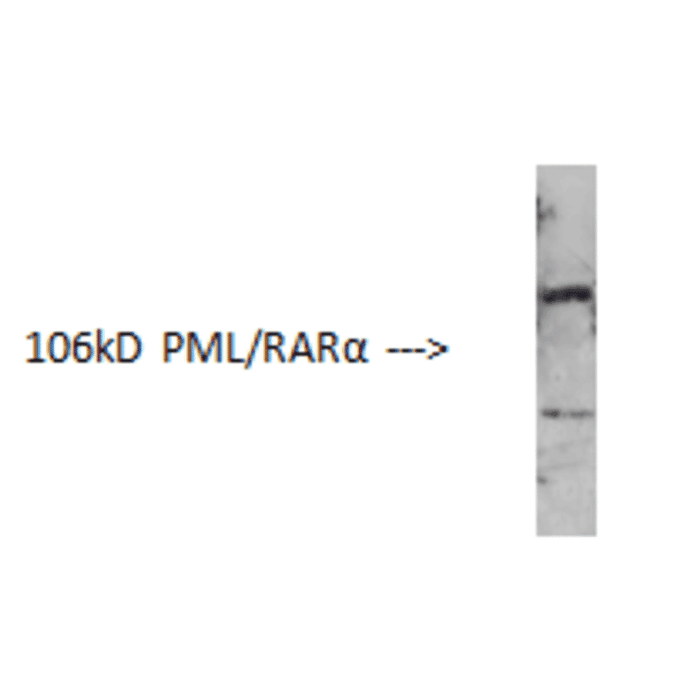 Western Blot - Anti-PML Protein Antibody (AI70002A) - Antibodies.com