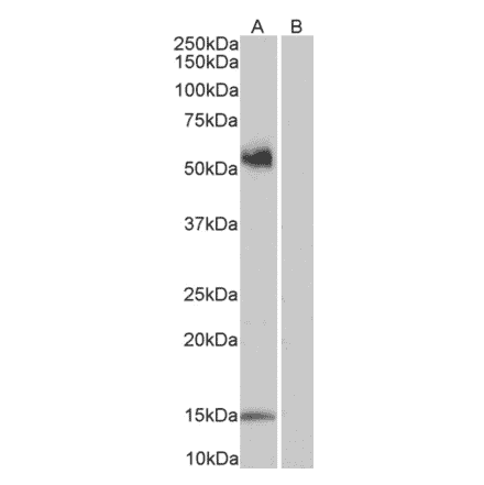 Western Blot - Anti-CD14 Antibody (A320050) - Antibodies.com