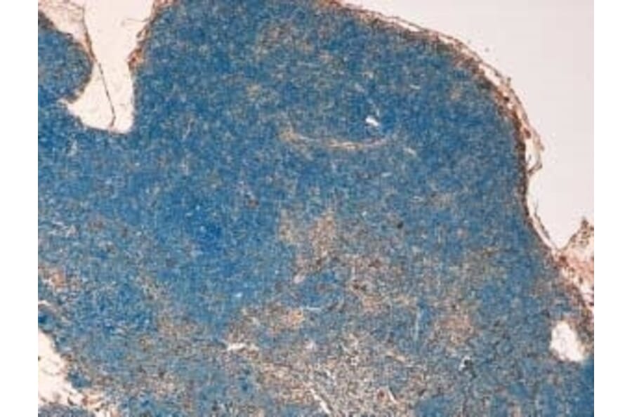Immunohistochemistry - Anti-STAT3 Antibody (A320057) - Antibodies.com