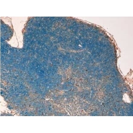 Immunohistochemistry - Anti-STAT3 Antibody (A320057) - Antibodies.com