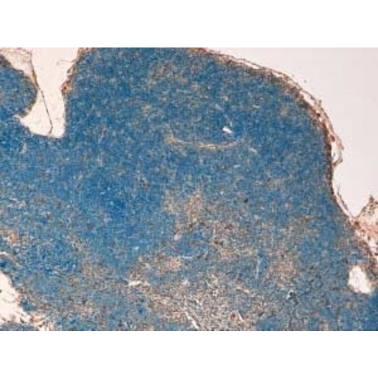 Immunohistochemistry - Anti-STAT3 Antibody (A320057) - Antibodies.com