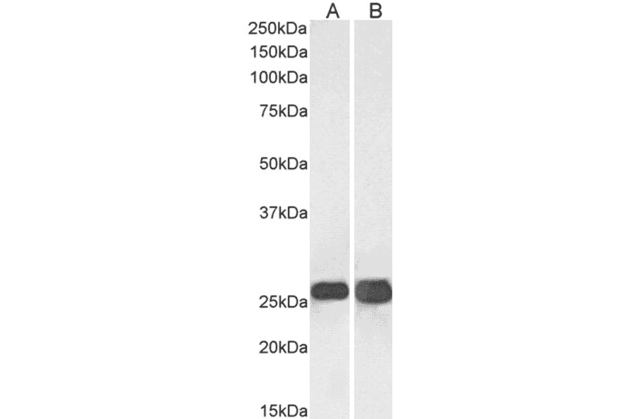 Western Blot - Anti-SNAP25 Antibody (A320061) - Antibodies.com