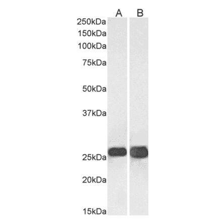 Western Blot - Anti-SNAP25 Antibody (A320061) - Antibodies.com