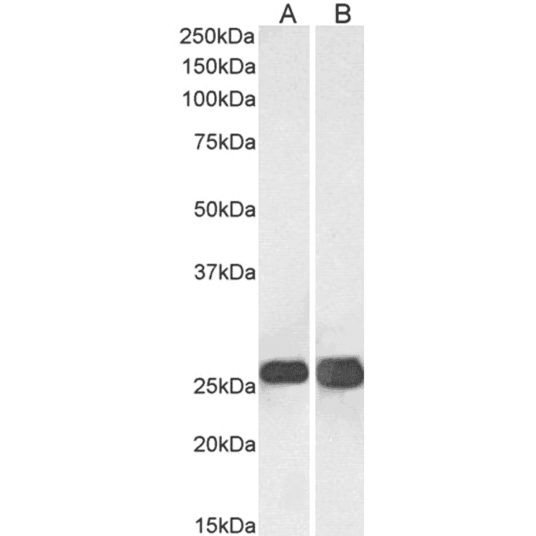 Western Blot - Anti-SNAP25 Antibody (A320061) - Antibodies.com
