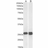 Western Blot - Anti-SNAP25 Antibody (A320061) - Antibodies.com