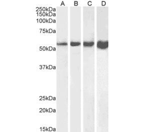 Western Blot - Anti-Desmin Antibody (A320080) - Antibodies.com