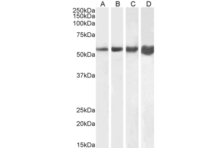 Western Blot - Anti-Desmin Antibody (A320080) - Antibodies.com