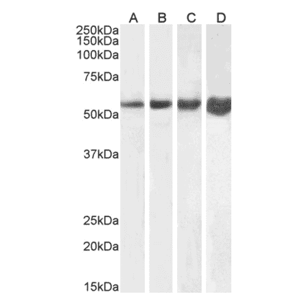 Western Blot - Anti-Desmin Antibody (A320080) - Antibodies.com