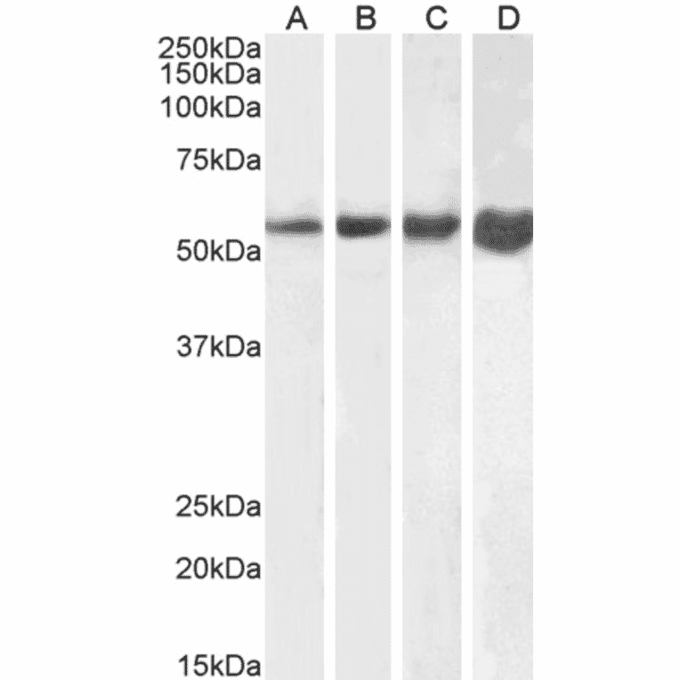 Western Blot - Anti-Desmin Antibody (A320080) - Antibodies.com