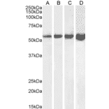 Western Blot - Anti-Desmin Antibody (A320080) - Antibodies.com