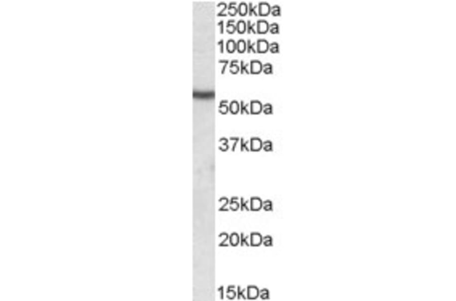 Western Blot - Anti-Desmin Antibody (A320080) - Antibodies.com