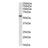Western Blot - Anti-Desmin Antibody (A320080) - Antibodies.com