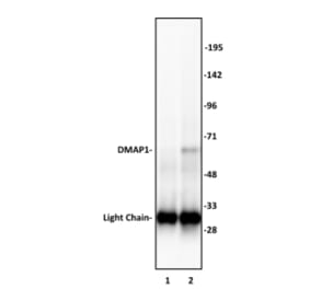 Immunoprecipitation  - Anti-DMAP1 Antibody (A320109) - Antibodies.com