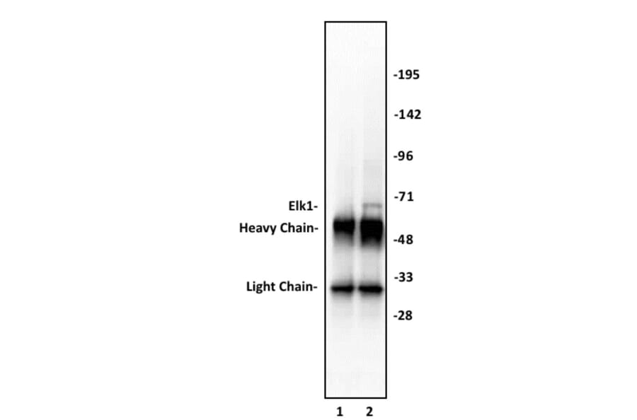 Immunoprecipitation  - Anti-ELK1 Antibody (A320110) - Antibodies.com