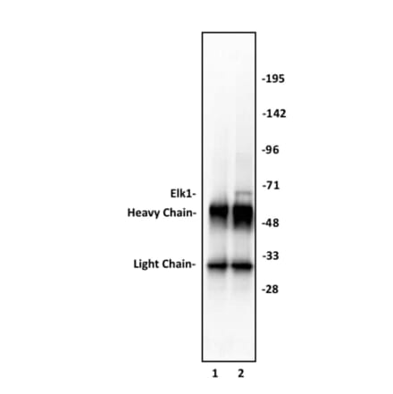 Immunoprecipitation  - Anti-ELK1 Antibody (A320110) - Antibodies.com