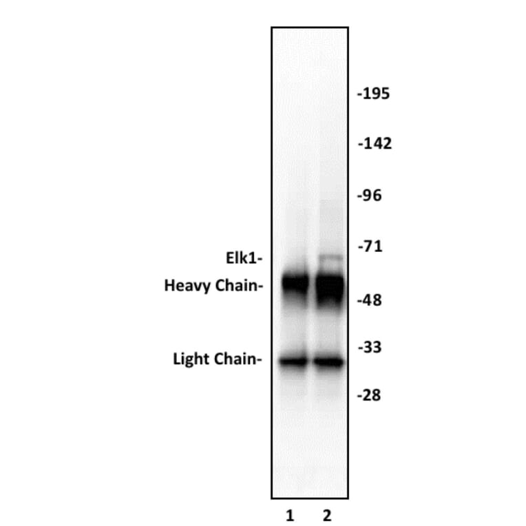 Immunoprecipitation  - Anti-ELK1 Antibody (A320110) - Antibodies.com