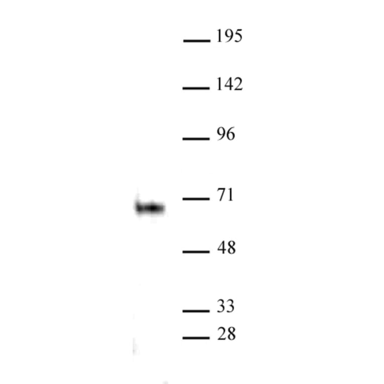 Western Blot - Anti-ELK1 Antibody (A320110) - Antibodies.com