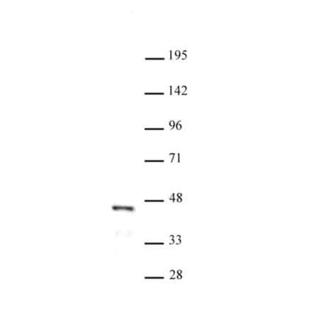 Western Blot - Anti-FOXL2 Antibody (A320112) - Antibodies.com
