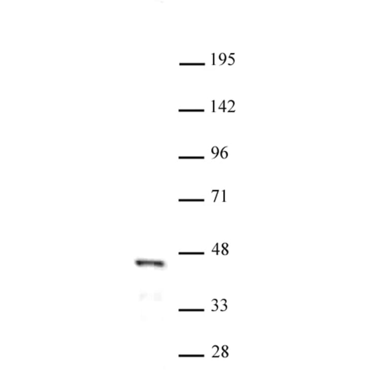Western Blot - Anti-FOXL2 Antibody (A320112) - Antibodies.com