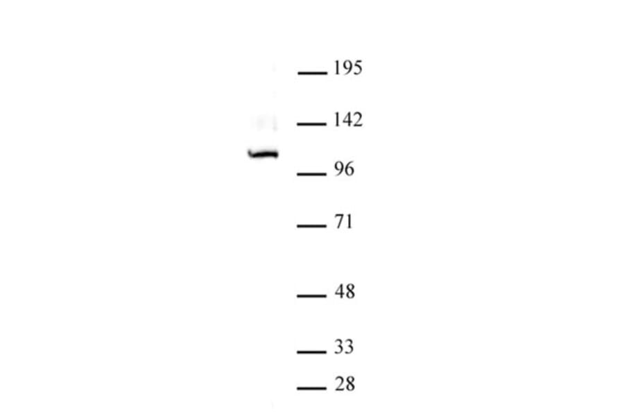 Western Blot - Anti-Gli1 Antibody (A320114) - Antibodies.com