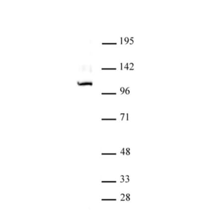 Western Blot - Anti-Gli1 Antibody (A320114) - Antibodies.com