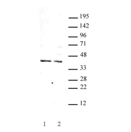 Western Blot - Anti-GSC Antibody (A320115) - Antibodies.com