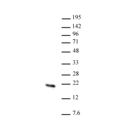 Western Blot - Anti-HMGN2 Antibody (A320148) - Antibodies.com