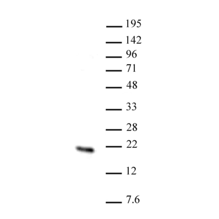 Western Blot - Anti-HMGN2 Antibody (A320148) - Antibodies.com