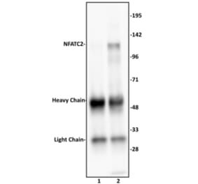 Immunoprecipitation  - Anti-NFAT1 Antibody (A320159) - Antibodies.com