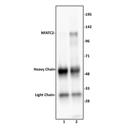 Immunoprecipitation  - Anti-NFAT1 Antibody (A320159) - Antibodies.com