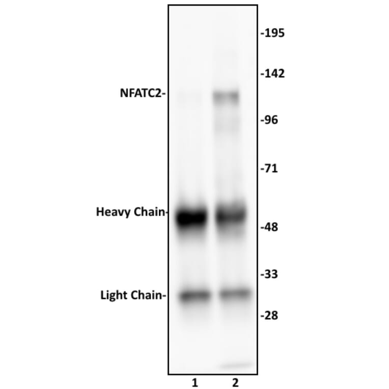 Immunoprecipitation  - Anti-NFAT1 Antibody (A320159) - Antibodies.com