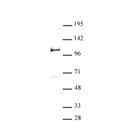 Western Blot - Anti-TZP Antibody (A320166) - Antibodies.com