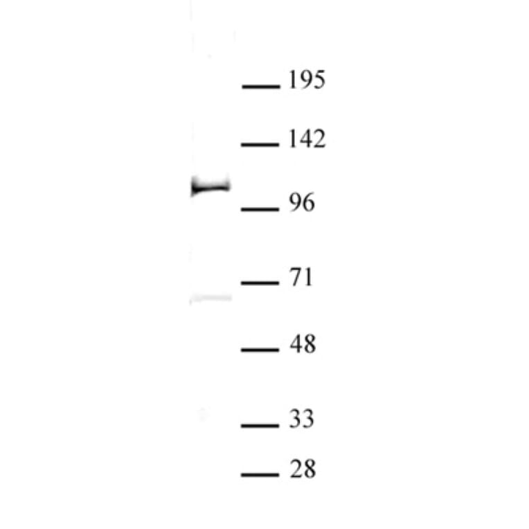 Western Blot - Anti-TZP Antibody (A320166) - Antibodies.com