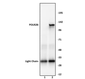 Immunoprecipitation  - Anti-RPB2 Antibody (A320168) - Antibodies.com
