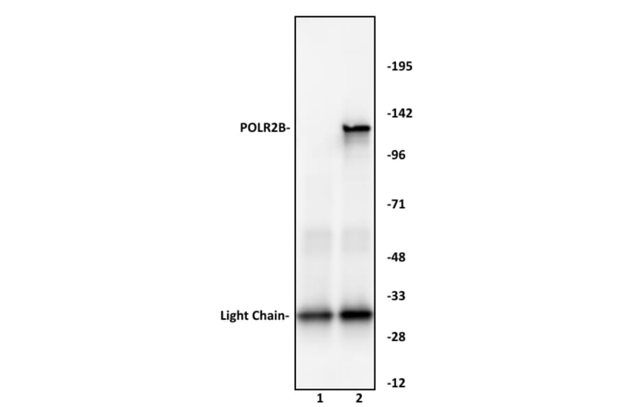 Immunoprecipitation  - Anti-RPB2 Antibody (A320168) - Antibodies.com