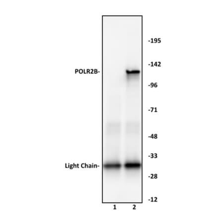 Immunoprecipitation  - Anti-RPB2 Antibody (A320168) - Antibodies.com
