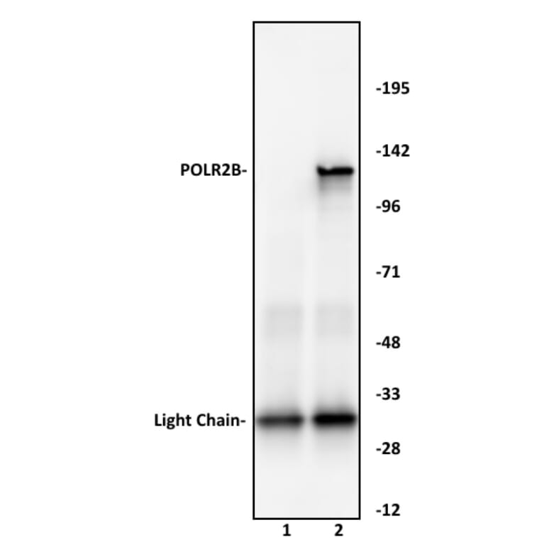 Immunoprecipitation  - Anti-RPB2 Antibody (A320168) - Antibodies.com