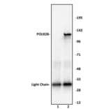 Immunoprecipitation  - Anti-RPB2 Antibody (A320168) - Antibodies.com