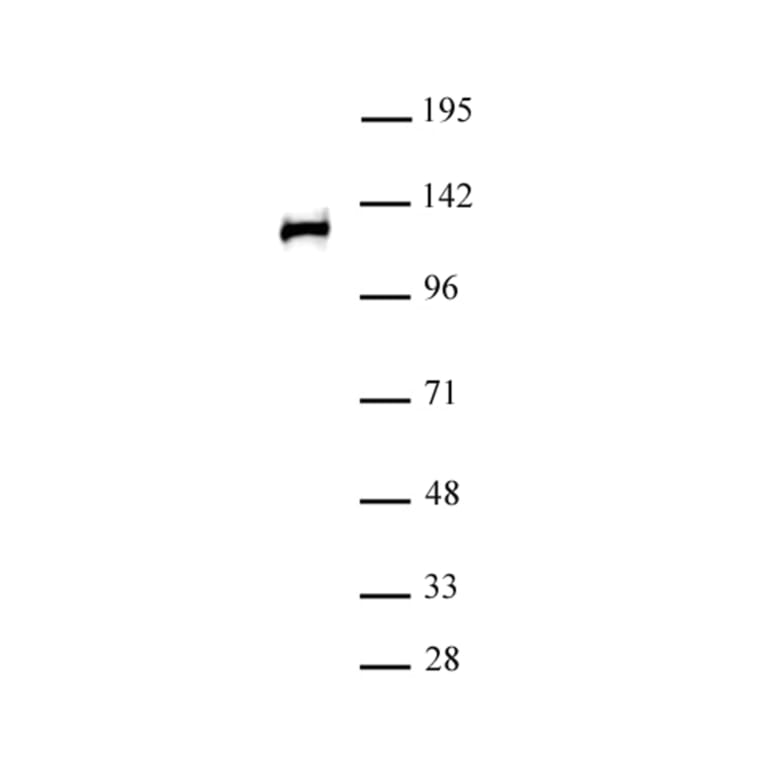 Western Blot - Anti-RPB2 Antibody (A320168) - Antibodies.com