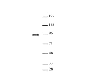 Western Blot - Anti-SATB2 Antibody (A320173) - Antibodies.com