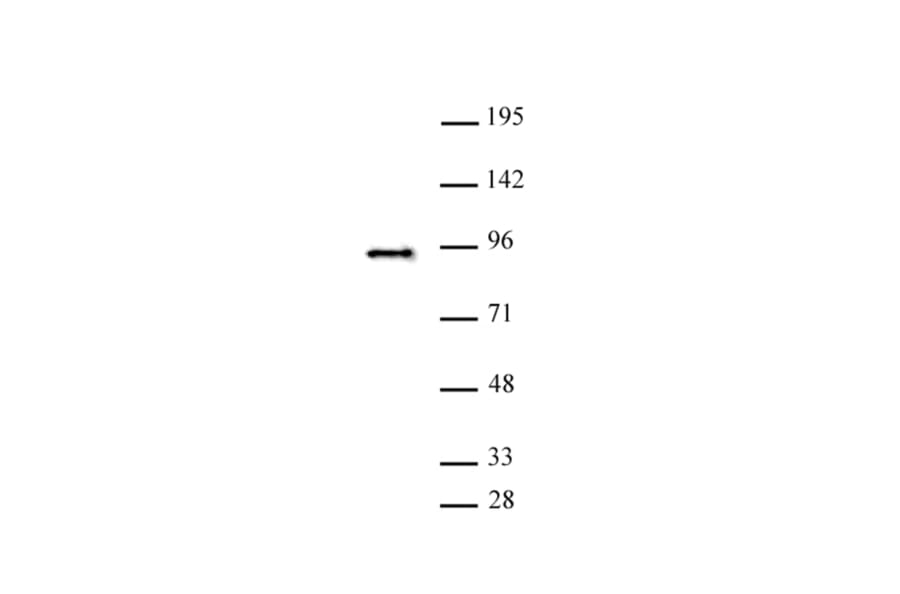 Western Blot - Anti-SATB2 Antibody (A320173) - Antibodies.com