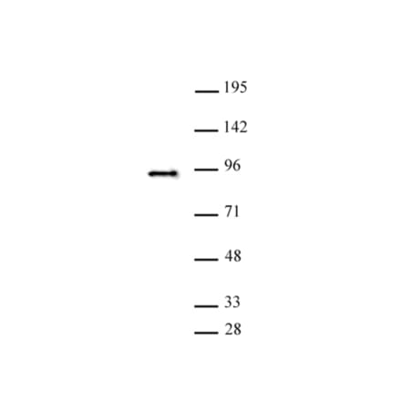 Western Blot - Anti-SATB2 Antibody (A320173) - Antibodies.com