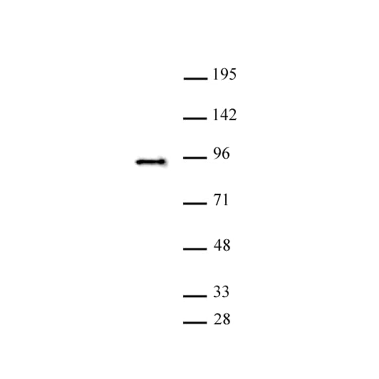 Western Blot - Anti-SATB2 Antibody (A320173) - Antibodies.com