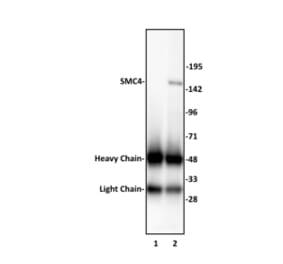 Immunoprecipitation  - Anti-SMC4 Antibody (A320175) - Antibodies.com