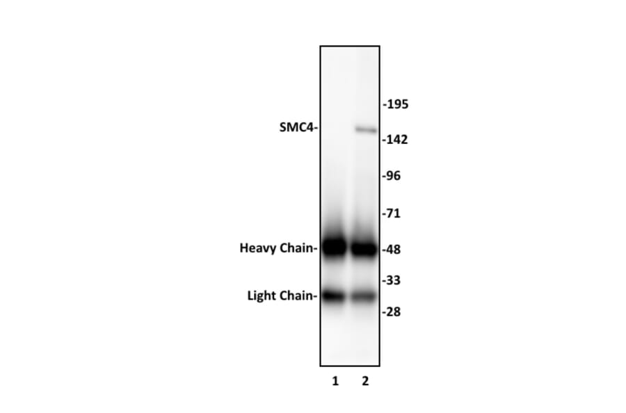 Immunoprecipitation  - Anti-SMC4 Antibody (A320175) - Antibodies.com