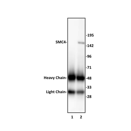 Immunoprecipitation  - Anti-SMC4 Antibody (A320175) - Antibodies.com