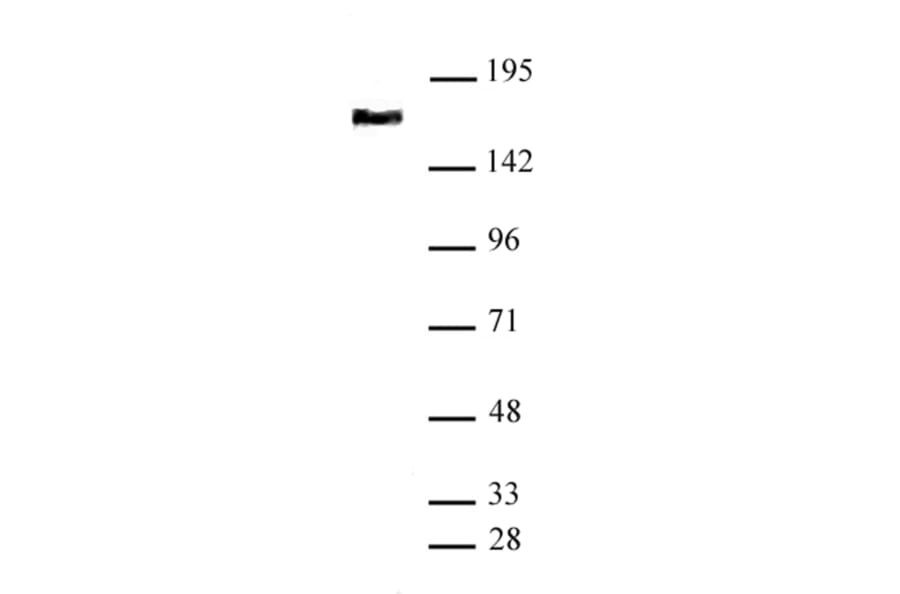 Western Blot - Anti-SMC4 Antibody (A320175) - Antibodies.com